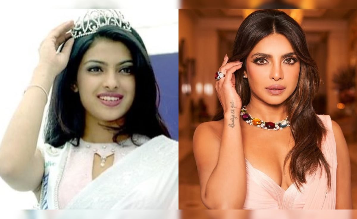 How Priyanka Chopra’s Father Reacted To The Actress’s Botched Nose Surgery